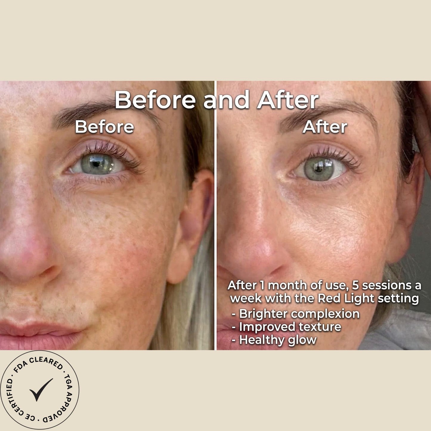 Pomelli’s® Lumora Series™ LED Light Contour Mask