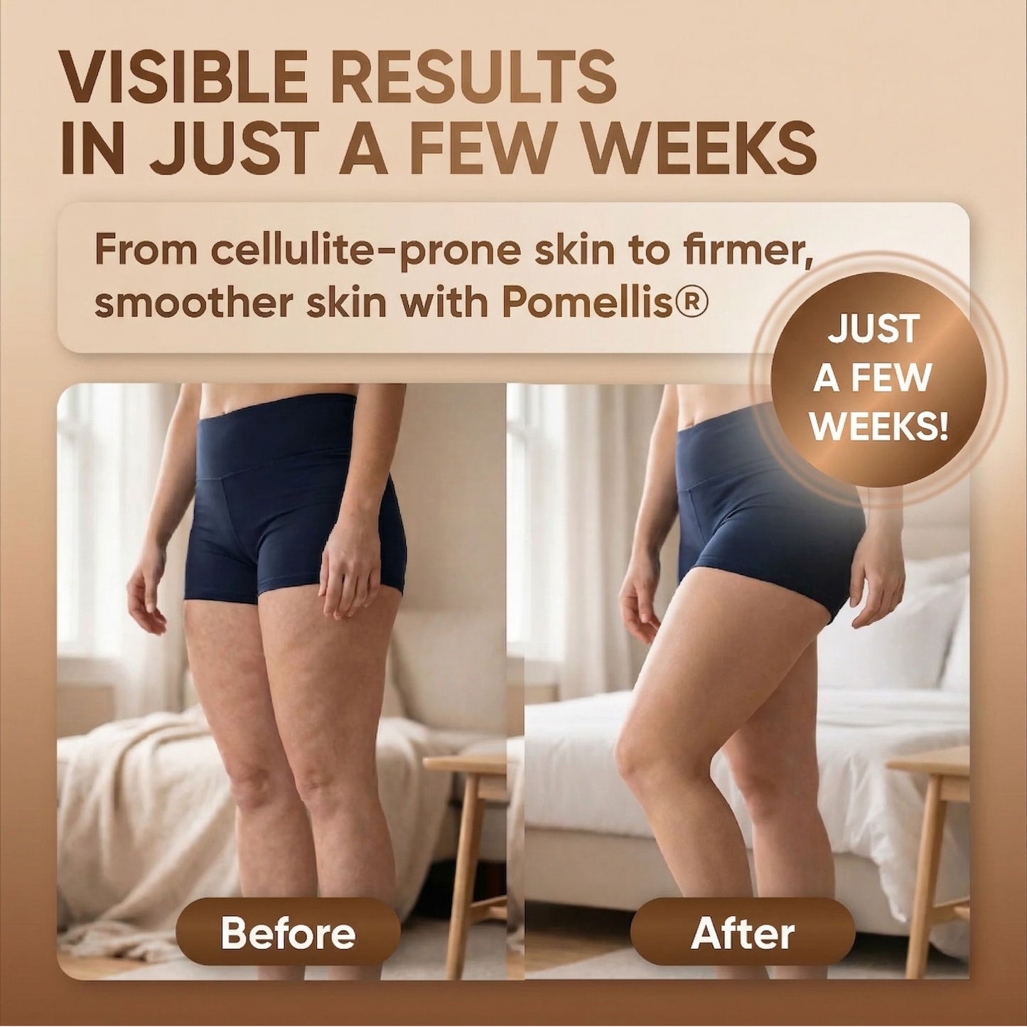 Pomelli's® Quadruple Action Anti-Cellulite Body Massager